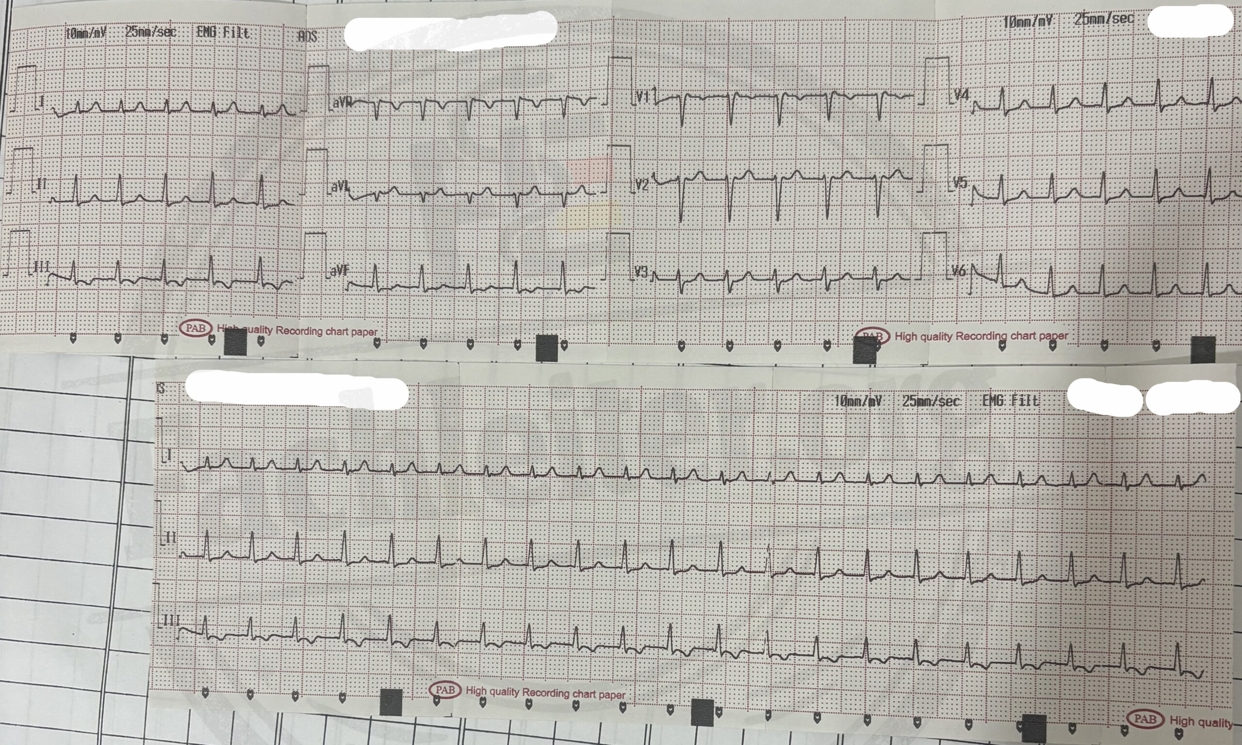 Fachleiter-EKG-22-Q2